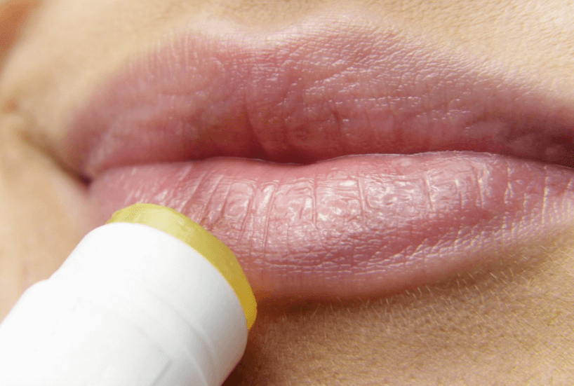 Dít is waarom je deze week geen lippenbalsem moet gebruiken