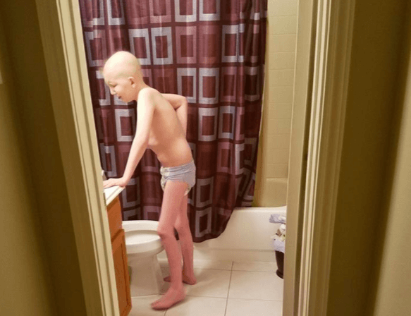 HEFTIG: deze moeder deelt een hartverscheurende foto van haar zieke zoon: "Dit doet kanker met een mens"