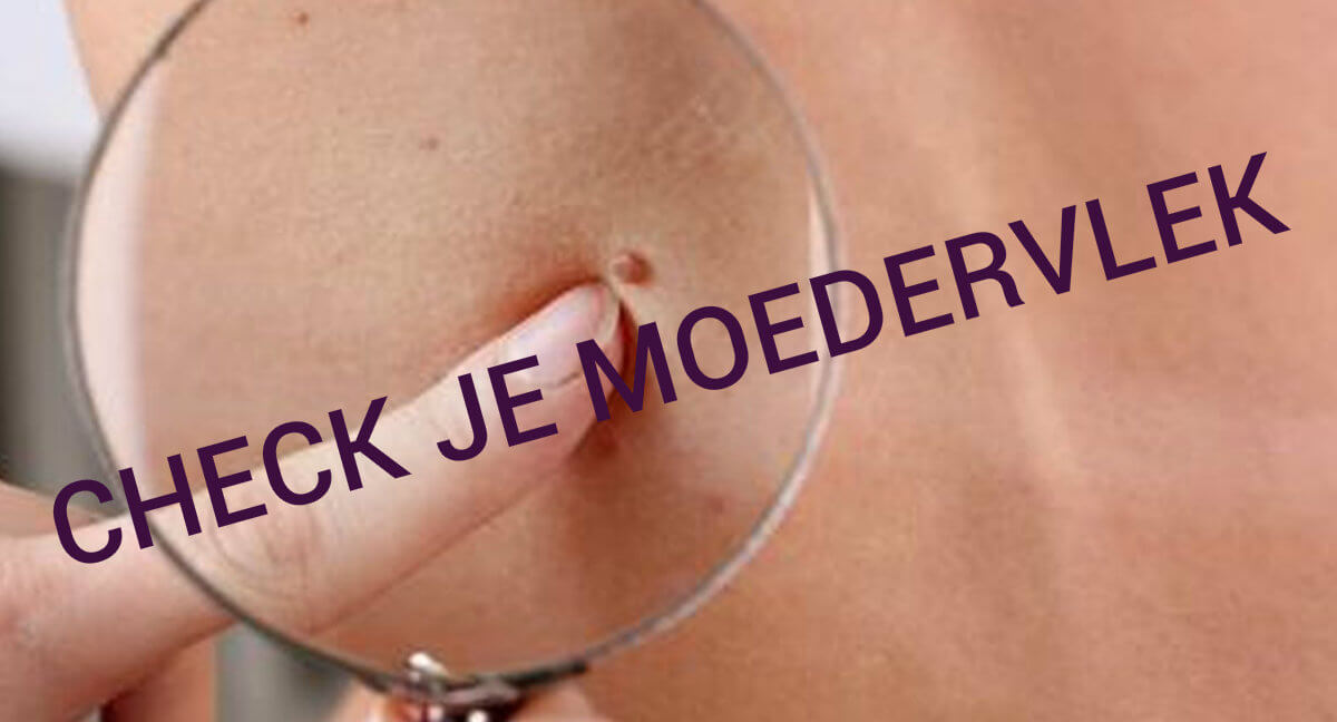 BELANGRIJK: zó herken je kwaadaardige moedervlekken op je huid! Dit moet iedereen even lezen, delen svp!