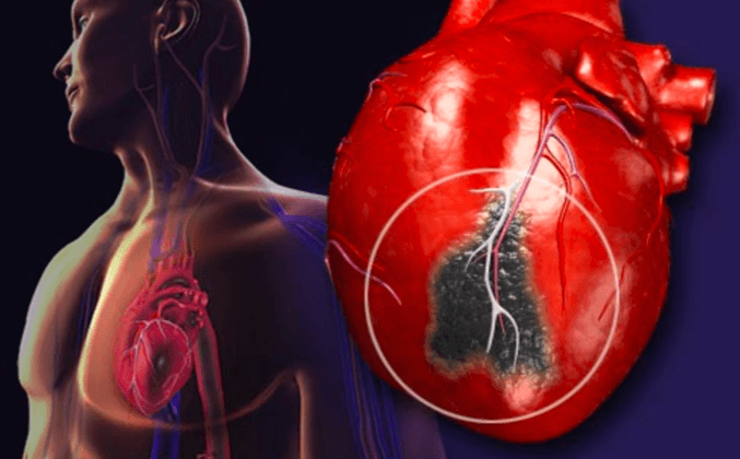 DIT zijn de zes voedingsmiddelen die cardiologen liever vermijden.. Dit wisten we nog niet!