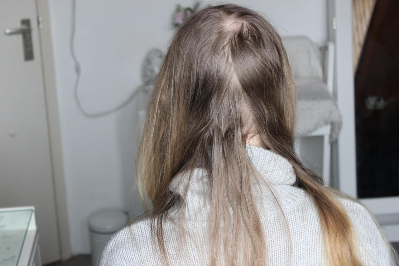 Pas op met het gebruik van droogshampoo, het maakt je haar kapot!
