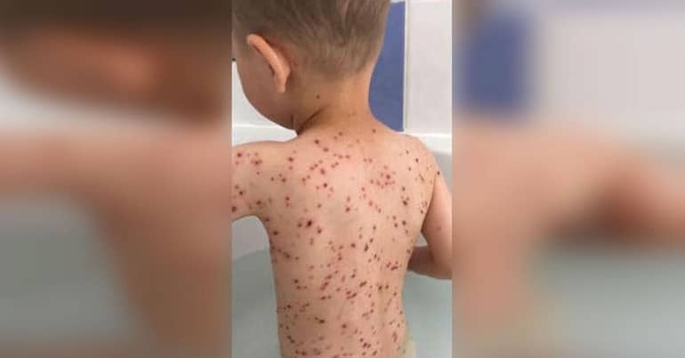 Waarschuwing! Heb je kinderen? Zorg dat ze dit niet overkomt, vreselijk dit verhaal!