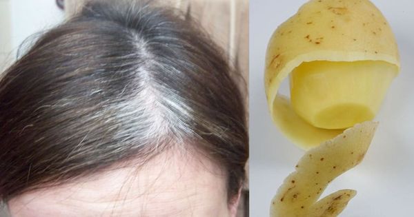 Last van grijze haren? Doe dit dan eens met een paar aardappelschillen!
