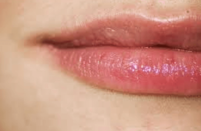 Je lippen zeggen iets over je gezondheid, wat zeggen die van jou?