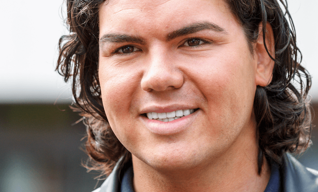 Oh nee, wat ontzettend vervelend voor Roy Donders! Wij leven met hem mee