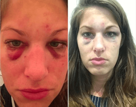 Deze vrouw wordt in elkaar geslagen door haar buurman en ZO gaat de politie ermee om.. Dit is toch schandalig? Delen svp!