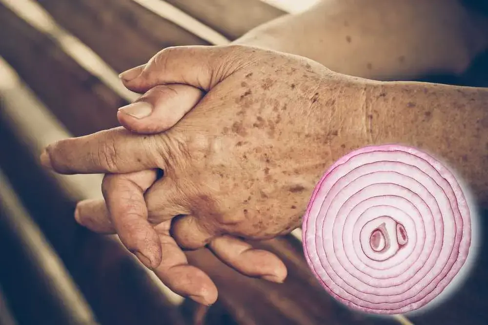 お肌にシミはありませんか？この簡単なトリックを使えば、すぐにシミを薄くすることができます！