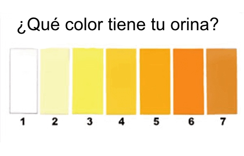 Esto dice el color de tu orina sobre tu salud